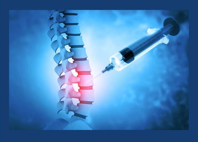 LamiStem procedure illustration